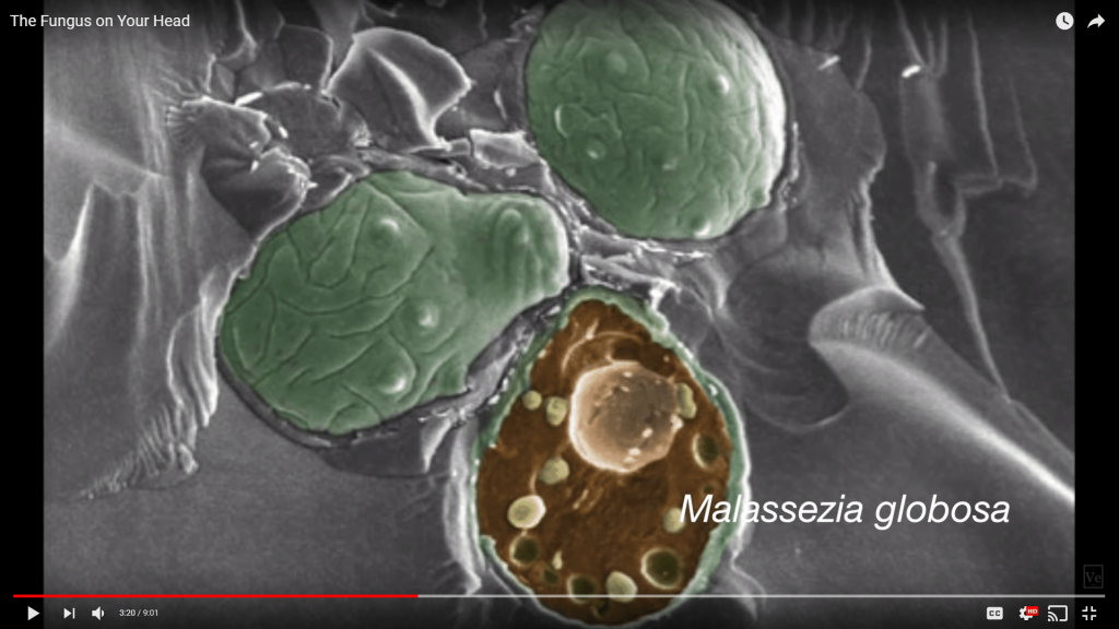 Malassezia globosa, the yeast behind dandruff, under magnification