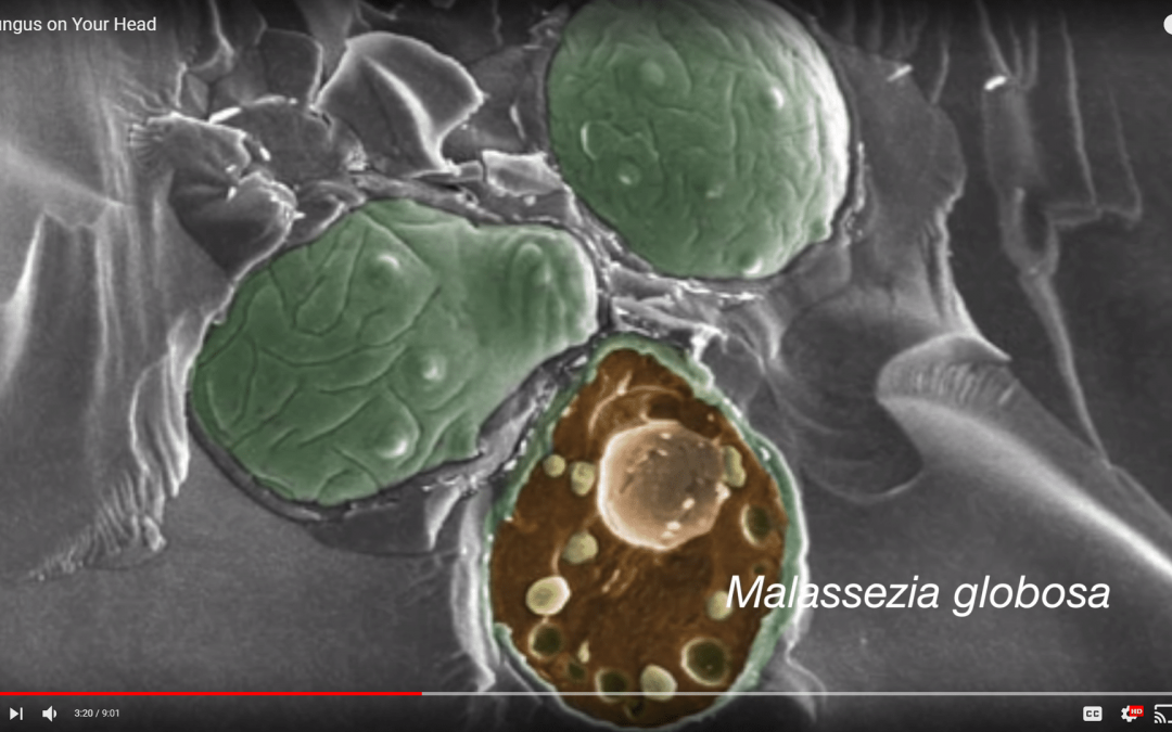 The Fungus on Our Heads
